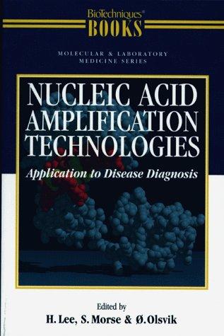 Nucleic acid amplification technologies  : application to disease diagnosis